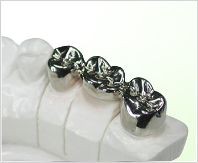 Metal Crown